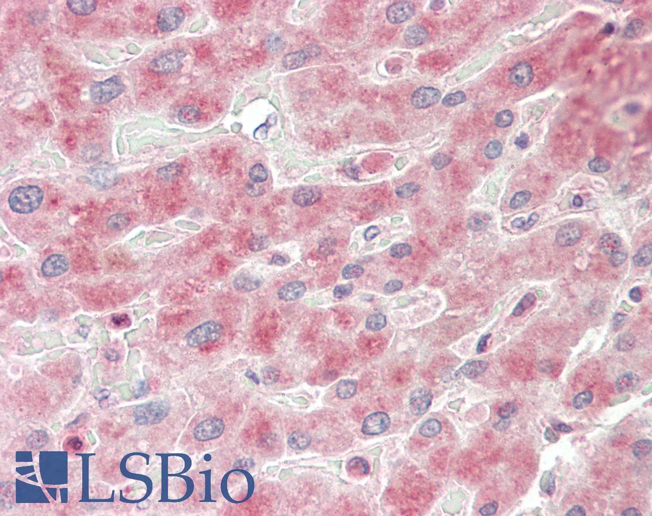 Polyclonal Rabbit anti-Human ANGPTL3 Antibody (aa43-92, IHC, WB)