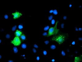 IHC-plus™ GIMAP4 Antibody (clone 1C6)