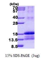 Human ID2 Protein (Recombinant His)