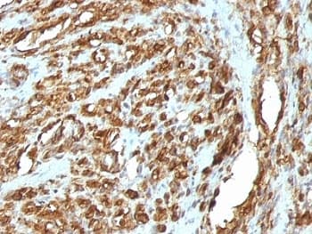 Muscle Actin Antibody (clone HHF35 + MSA/953)