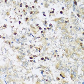 ATP2A3 / SERCA3 Antibody
