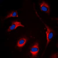 ETK / BMX Antibody (C-Terminus)