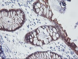 IRF6 Antibody (clone OTI2C10, Carrier-free)