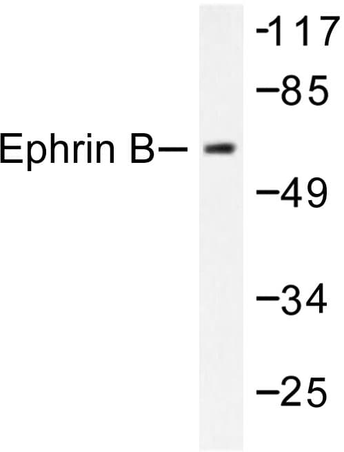 Ephrin B1+B2 Antibody (Gln324)