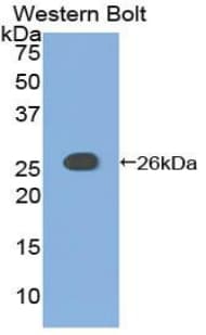 ADCY6 / Adenylate Cyclase 6 Antibody (aa246-435, Biotin)