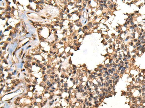 CASK Antibody