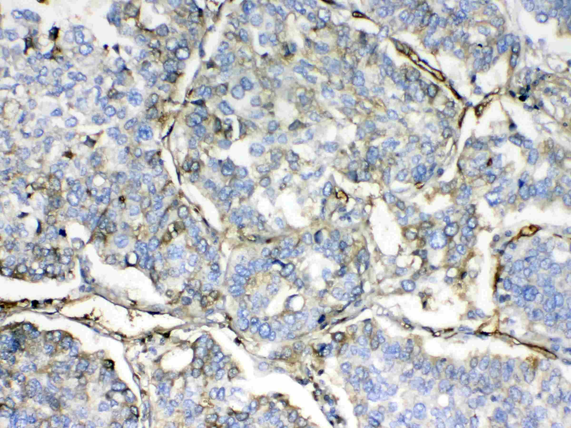 HBD / Hemoglobin Delta Antibody