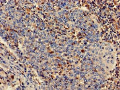PLS3 / T Plastin Antibody