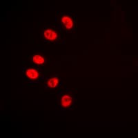 COUP-TFII / NR2F2 Antibody (N-Terminus)