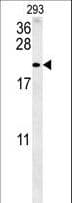 Polyclonal Rabbit anti-Human TAC1 Antibody (aa102-129, WB)
