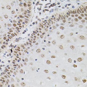 TGM2 / Transglutaminase 2 Antibody