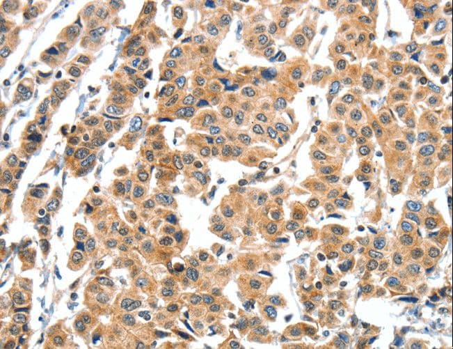 XBP1 Antibody