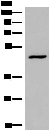 DCP2 Antibody