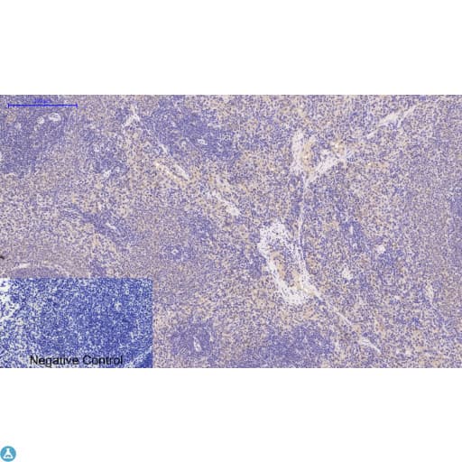DES / Desmin Antibody