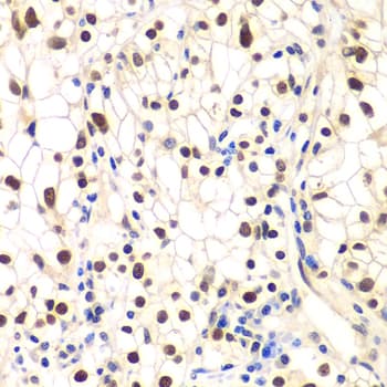 Polyclonal Rabbit anti-Human NFKBIB / IKB Beta / IKBB Antibody (IHC, IF, WB)