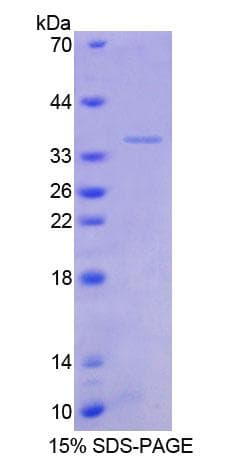 Human TSC22D1 / TSC22 Protein (Recombinant His-T7)
