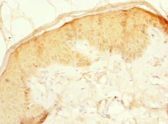 Polyclonal Rabbit anti-Human CFAP20 / GTL3 Antibody (IHC)