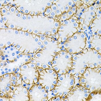 Polyclonal Rabbit anti-Human MAPT / Tau Antibody (IHC, IF, WB)