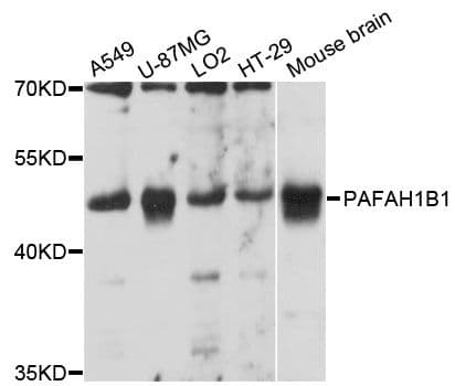 Polyclonal Rabbit anti-Human PAFAH1B1 / LIS1 Antibody (WB)