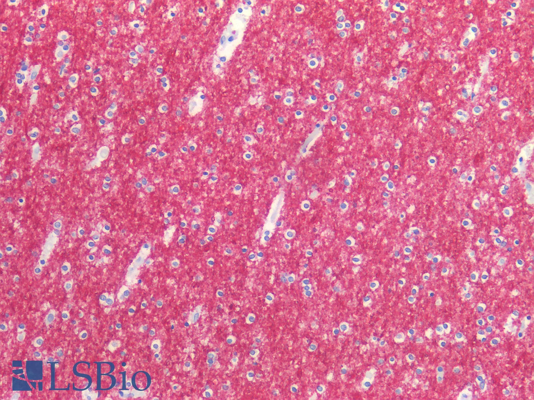 IHC-plus™ GRIN1 / NMDAR1 Antibody
