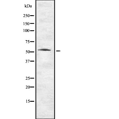 TMPRSS2 / Epitheliasin Antibody