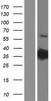 PRPS2 Protein (Over-Expression Lysate Myc-DDK (Flag))