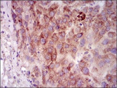 PRKACG Antibody (clone 20000)