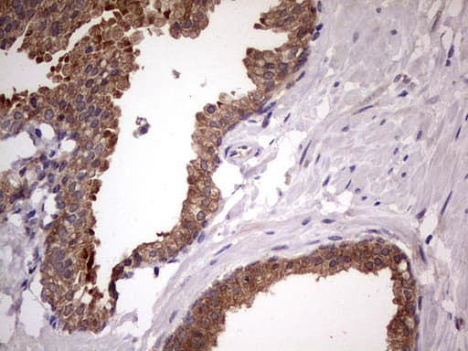DDX6 Antibody (aa1-298, clone OTI2D6, Carrier-free)