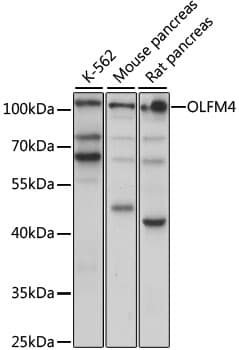 Polyclonal Rabbit anti-Human OLFM4 / Olfactomedin 4 Antibody (WB)