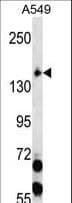 IHC-plus™ Polyclonal Rabbit anti-Human EIF2AK3 / PERK Antibody (aa73-102, IHC, WB)