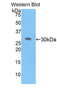 IRAK2 / IRAK-2 Antibody (aa209-458, Biotin)