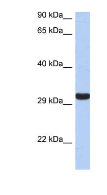 GZMK / Granzyme K Antibody (aa143-192)