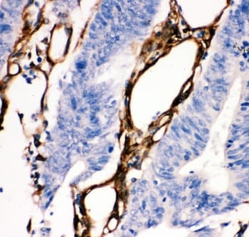 HSPB1 / HSP27 Antibody