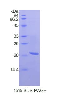 Mouse SERPINB4 / SCCA1+2 Protein (Recombinant His)