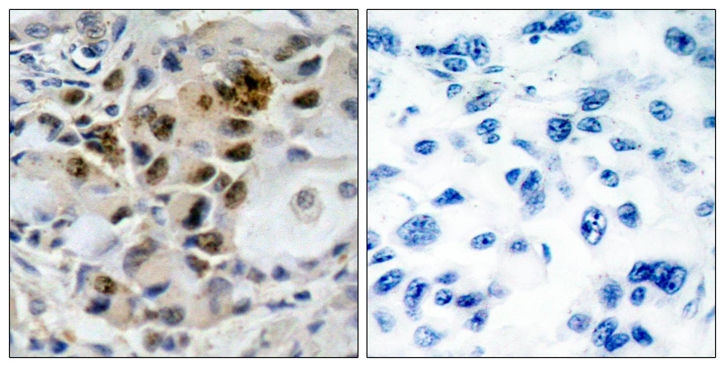 FOXO4 / AFX1 Antibody (p197)