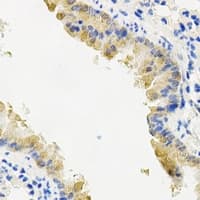 Polyclonal Rabbit anti-Human PYGL Antibody (IHC, IF, WB)