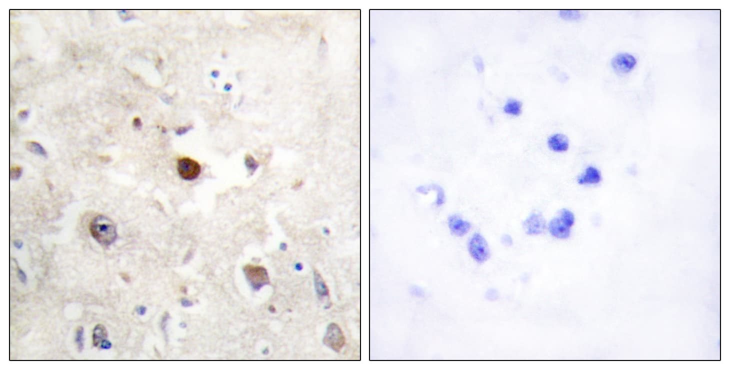 Polyclonal Rabbit anti-Human CDKN1C / p57 Kip2 Antibody (aa11-60, IHC)