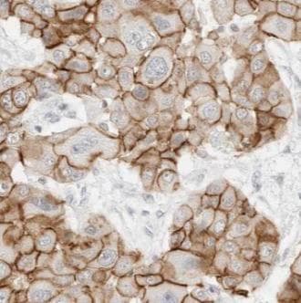 ABCB1 / MDR1 / P Glycoprotein Antibody
