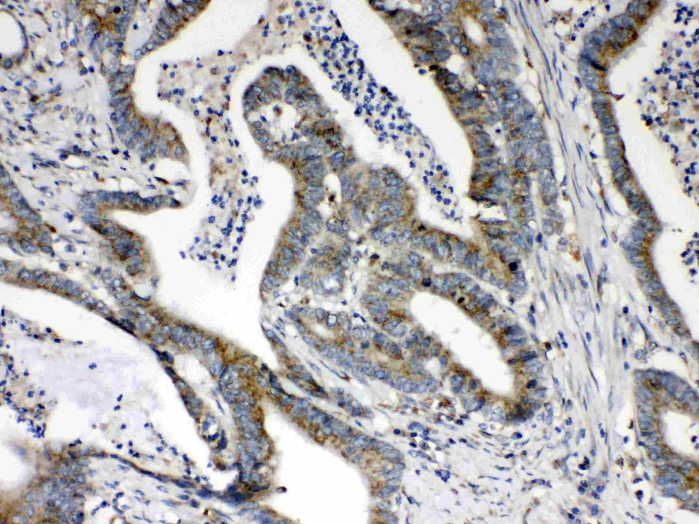Polyclonal Rabbit anti-Human HSD17B4 Antibody (IHC, WB)