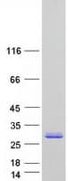Human NUDT7 Protein (Recombinant Myc-DDK (Flag))