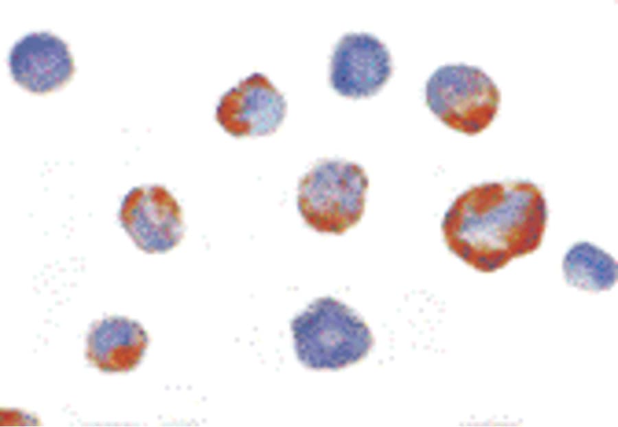 IHC-plus™ Polyclonal Rabbit anti-Human PAK7/PAK5 Antibody (IHC, IF, WB)