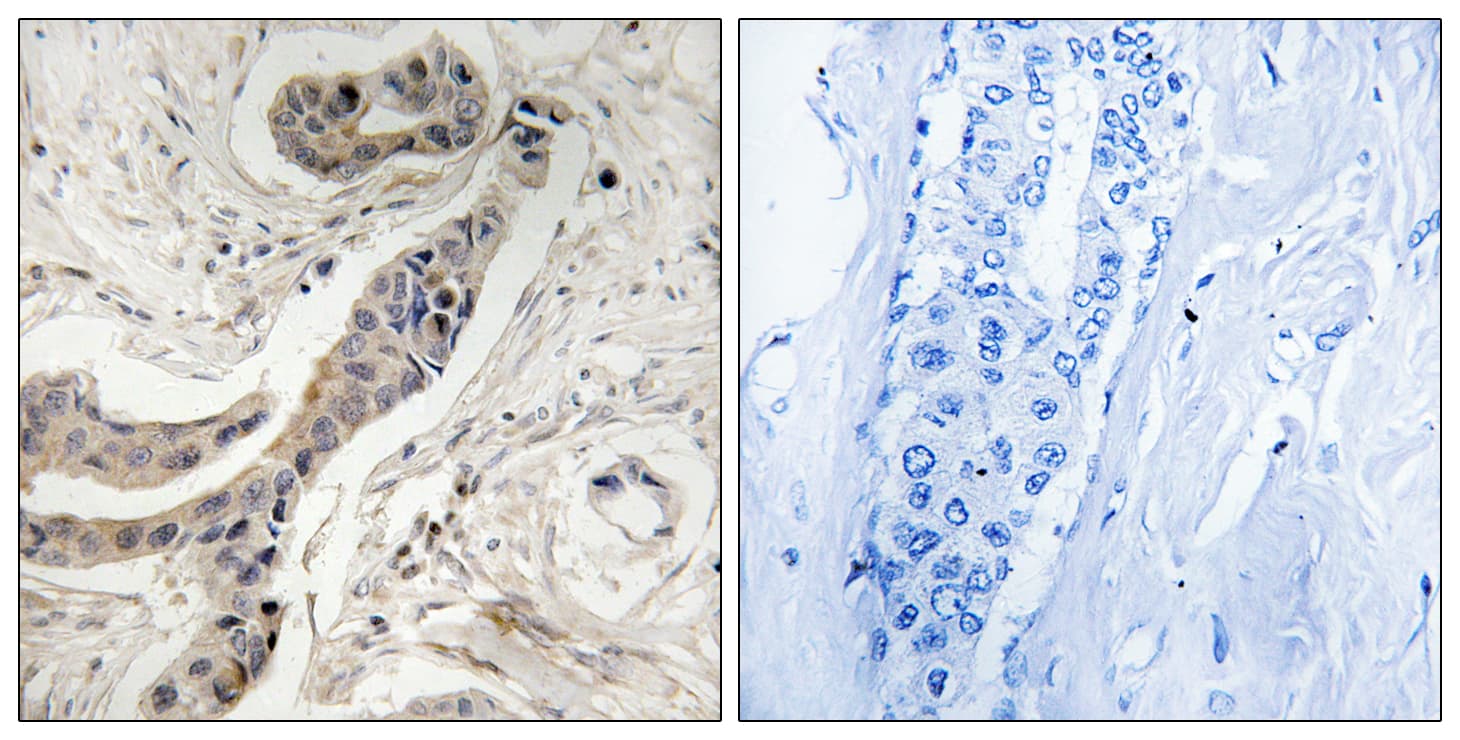 BCL2L1 / BCL-XL Antibody (phospho-Thr115)
