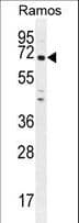 PNLDC1 Antibody (aa449-478)