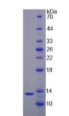 Human IL17F Protein (Recombinant His)