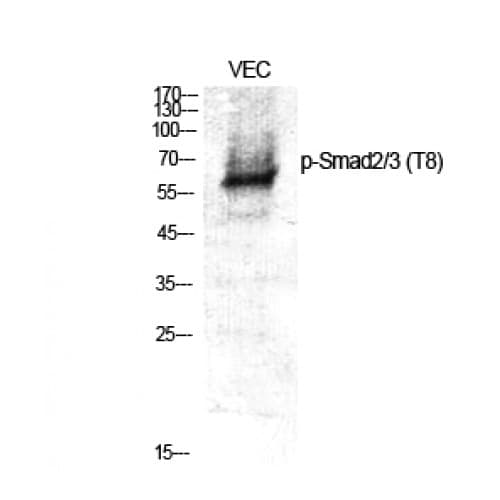 SMAD2+3 Antibody (1-80 aa)