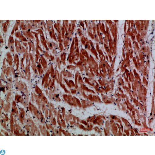 Polyclonal Rabbit anti-Human Myosin VI / MYO6 Antibody (WB)