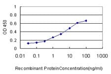 TIMM8A Antibody (clone 2F11)