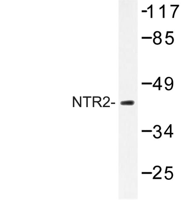 NTSR2 / NTR2 Antibody (Asp184)