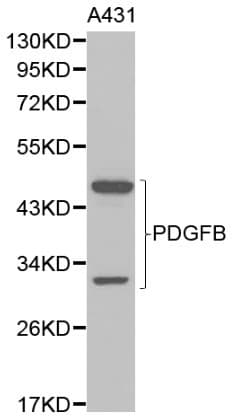 IHC-plus™ Polyclonal Rabbit anti-Human PDGF-BB Antibody (IHC, WB)