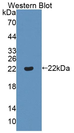 ADAMTS13 Antibody